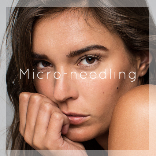 Micro Needling 2